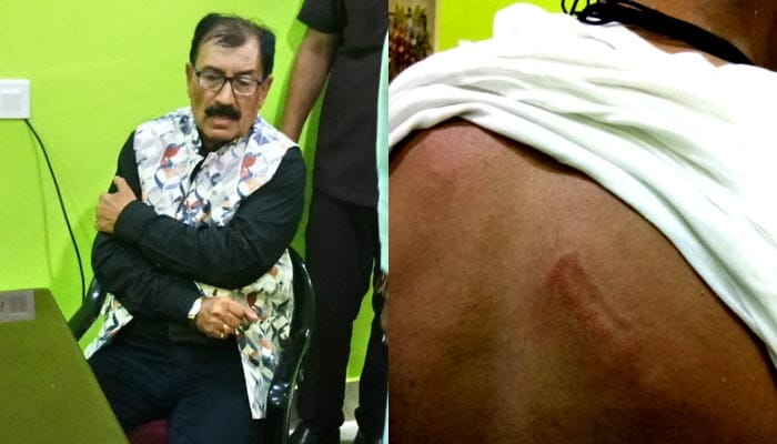 d453f trinamool prasun banerjee injured