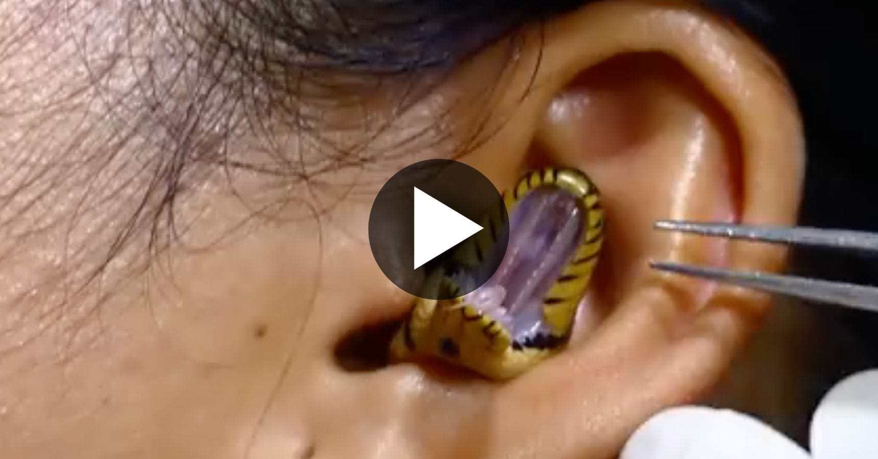 snake in ear