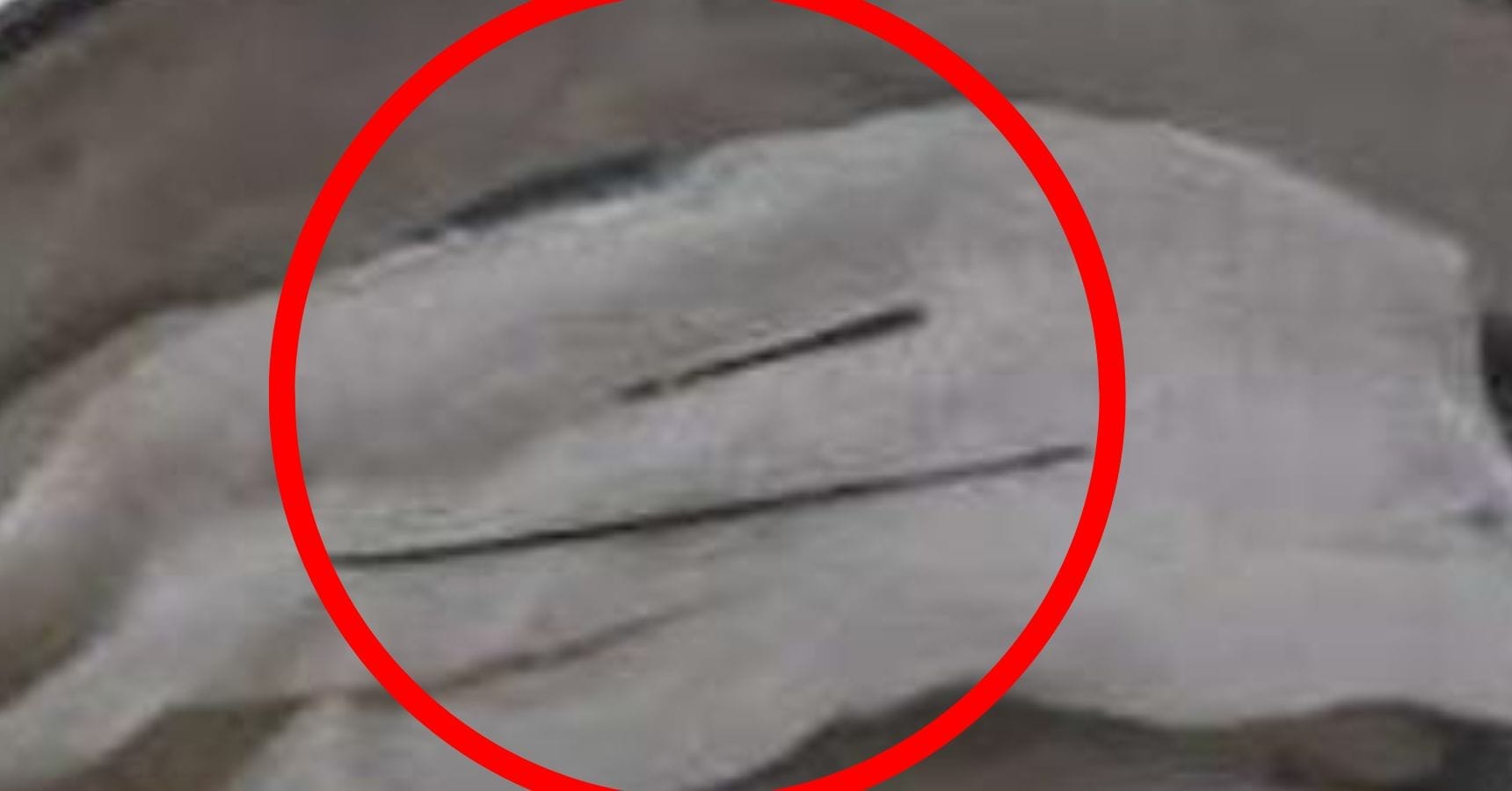 needle in private parts