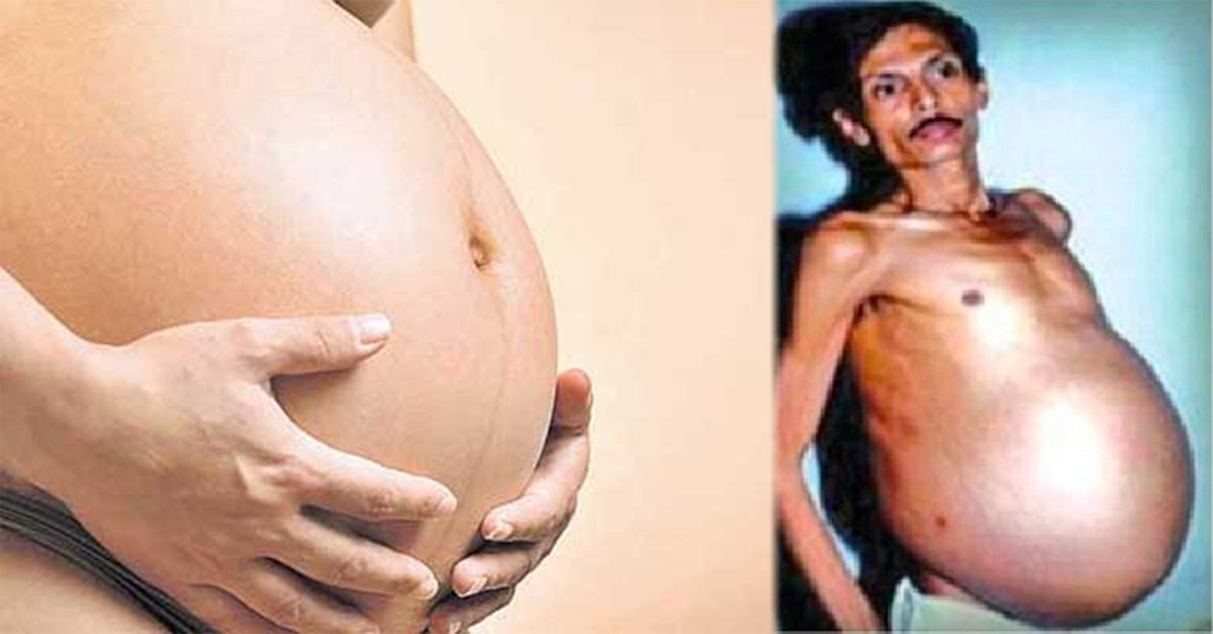 pregnent man news