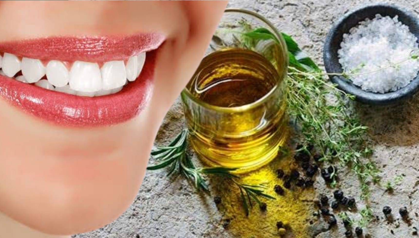 teeth whitening