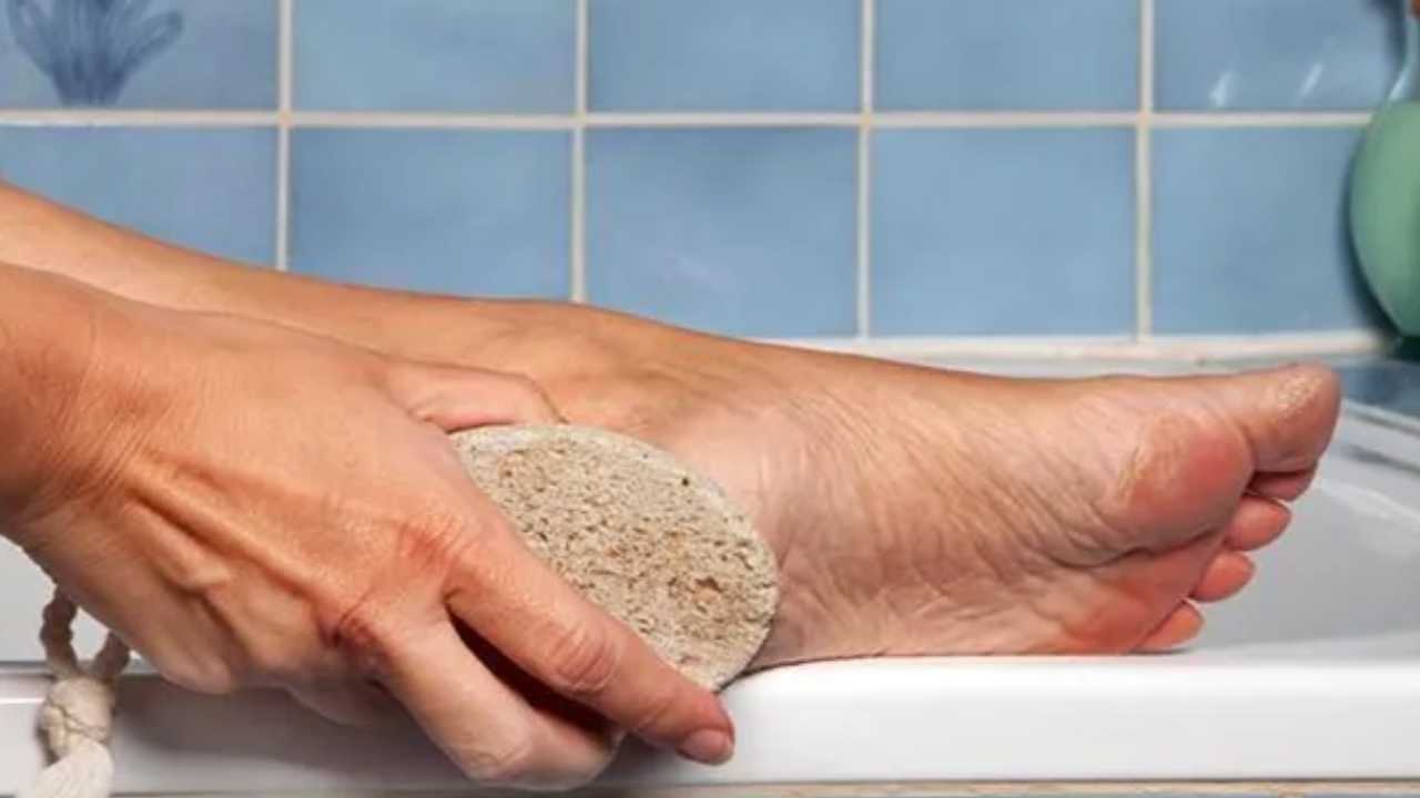 How to take care of your feet to avoid cracked heel in winter