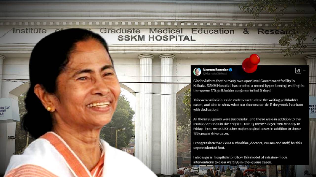 SSKM Hospital creates a record CM Mamata Banerjee shares the good news