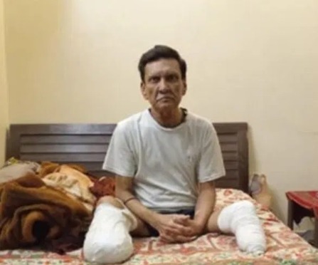 Hindu cricketer loses both legs in Pakistan.