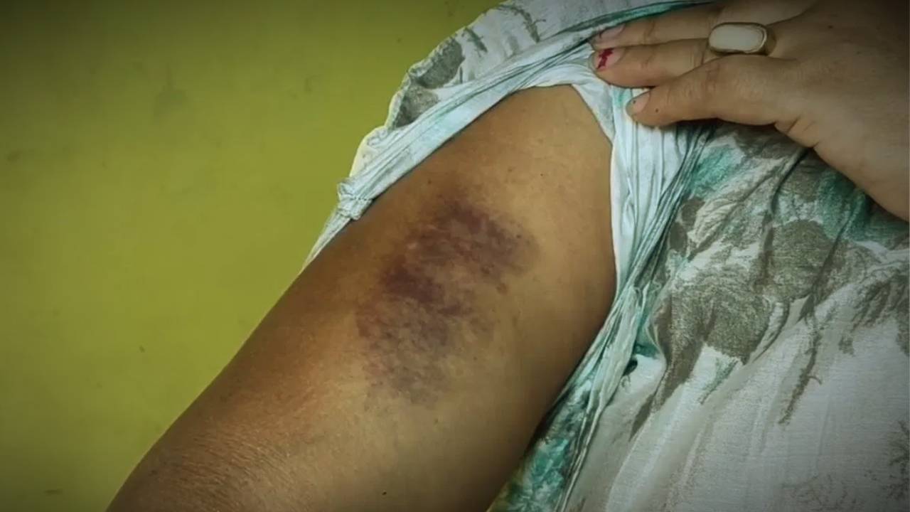Allegation of physical abuse to wife against Trinamool Congress councilor