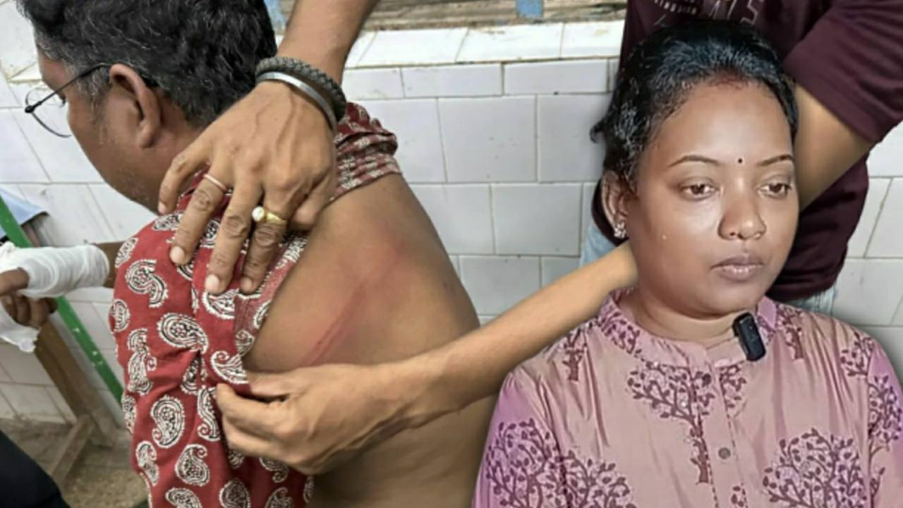 State minister jyostna mandi husband injured in attack