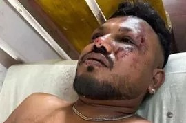 How did a passenger survive the Ahmedabad Plane Crash.
