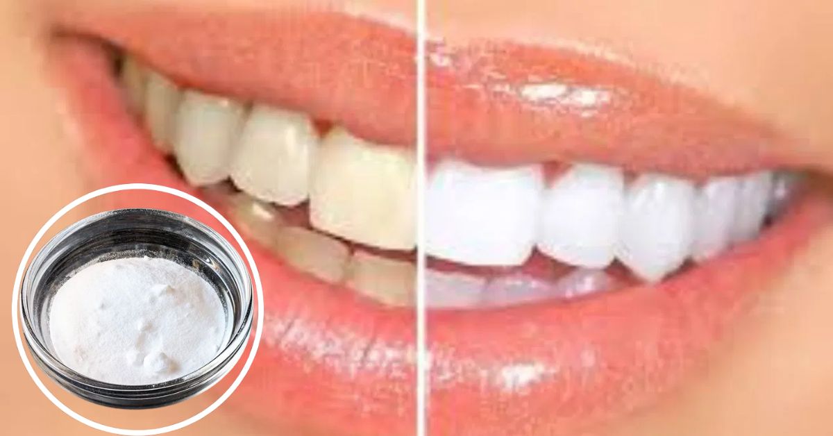Dental Health here are home remedies that may help to get rid of yellow teeth
