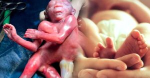 Bardhaman a strange baby born with four arms and four legs doctor shocked