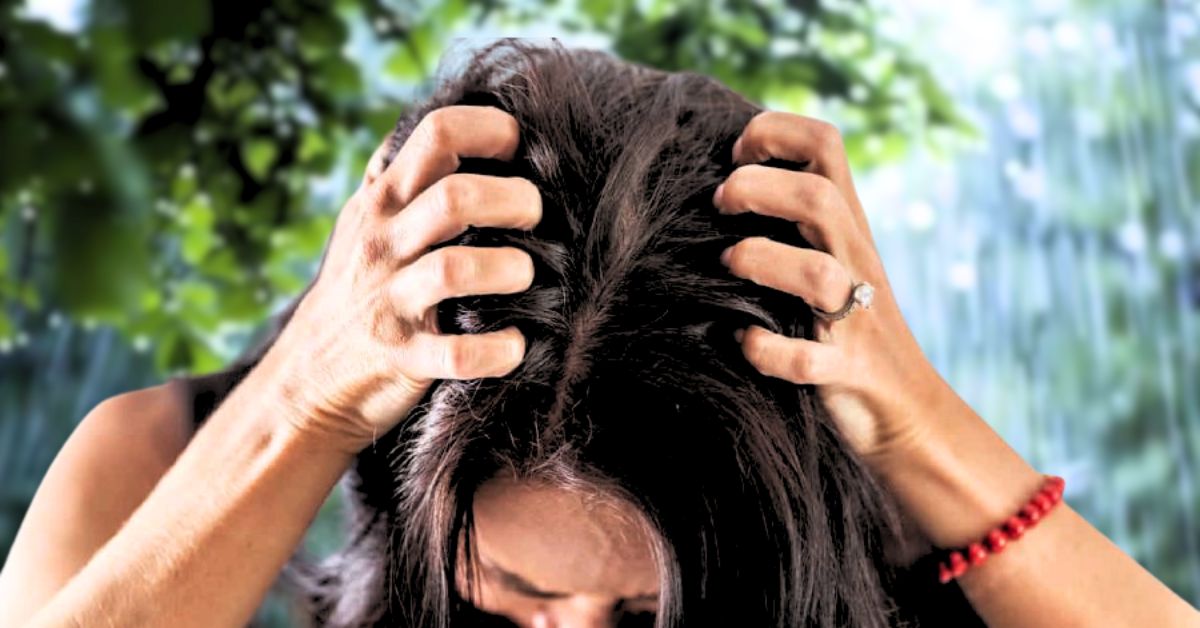 Hair Care Itchy scalp during the monsoon season get relief with this home remedy