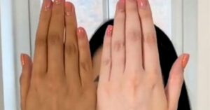 Skin Care useful tips to remove tan from your hand