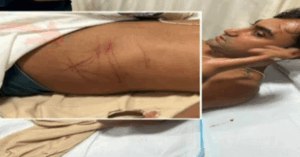 Journalist Kishalay Mukherjee attacked in Kolkata