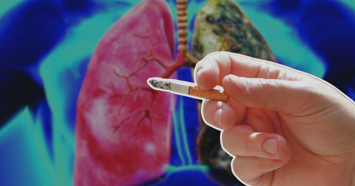 Health lung cancer can occur even if you don't smoke know the symptoms of the disease