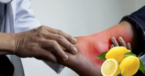 Health Tips make small changes to your diet to control uric acid without medication