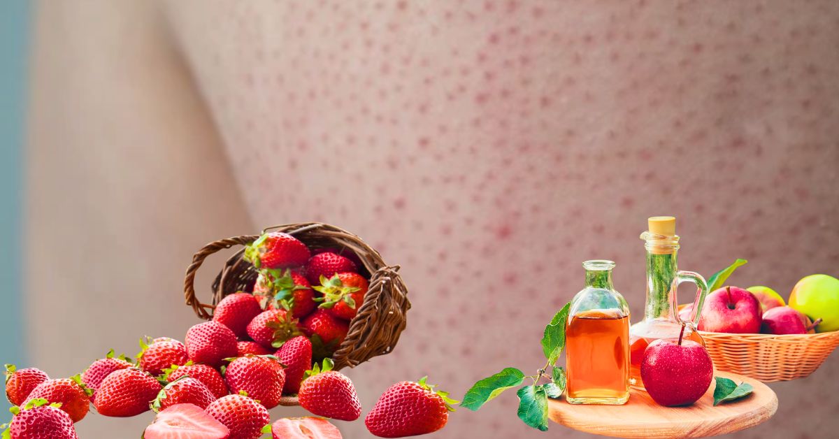 Skin Care millions of people are suffering from strawberry skin problem know the remedy