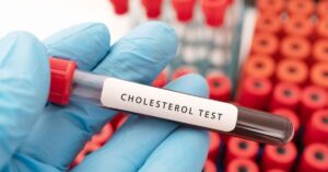 Health Tips cholesterol patients should not forget to eat these 4 foods during Puja