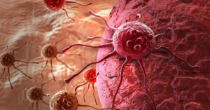 Health home remedies to prevent cancer sipping on a special drink is beneficial