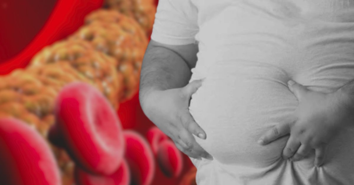 Health Tips follow these 5 things to keep cholesterol under control