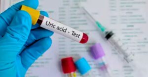 Health high uric acid in the body apart from joint pain other symptoms appear