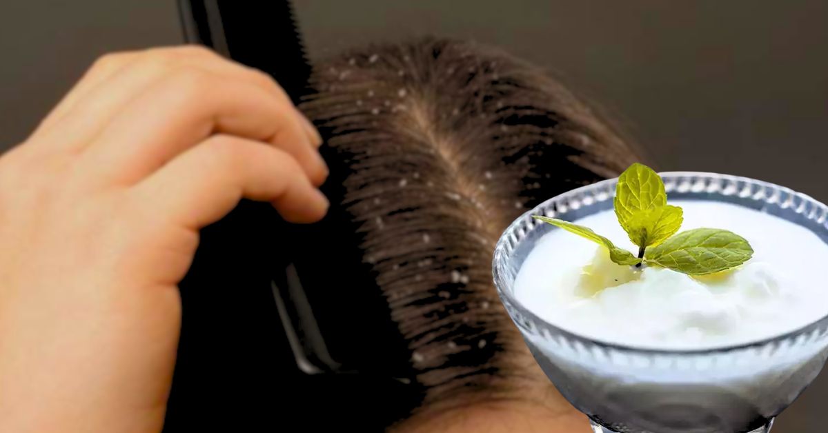 Hair Care prevent dandruff before winter use these simple tips
