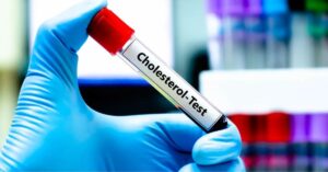 Health the key to lowering cholesterol lies in your habits know the advice of doctors
