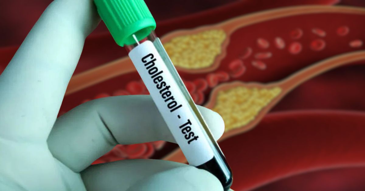 Health the key to lowering cholesterol lies in your habits know the advice of doctors