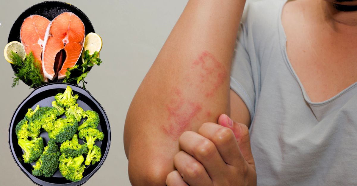 Heath eat these 5 healthy foods a day to avoid allergies