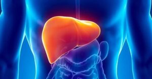 Health how effective are tea and coffee for fatty liver
