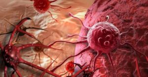 Health eat these 4 foods every day to prevent cancer