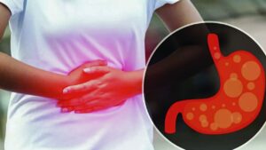 Health do you suffer from constipation in winter follow these 8 rules