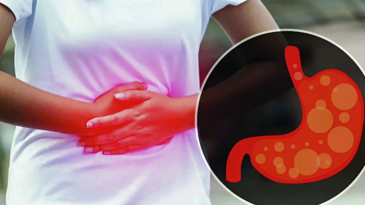 Health do you suffer from constipation in winter follow these 8 rules