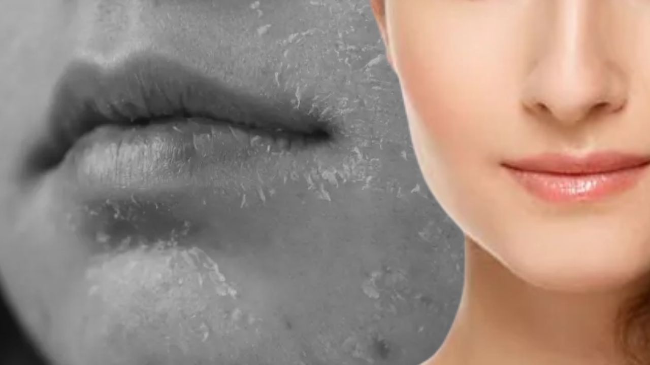 Skin Care does your skin get dry in winter applying this oil regularly will reduce the problem