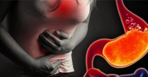 Health some daily habits are increasing gas and heartburn be careful now