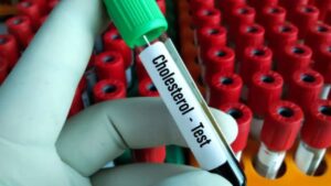 Health your body cholesterol increasing follow these health tips to stay healthy during winter