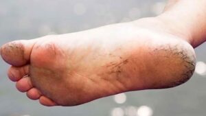 Skin Care not expensive creams but this home remedy will keep your feet soft even in winter