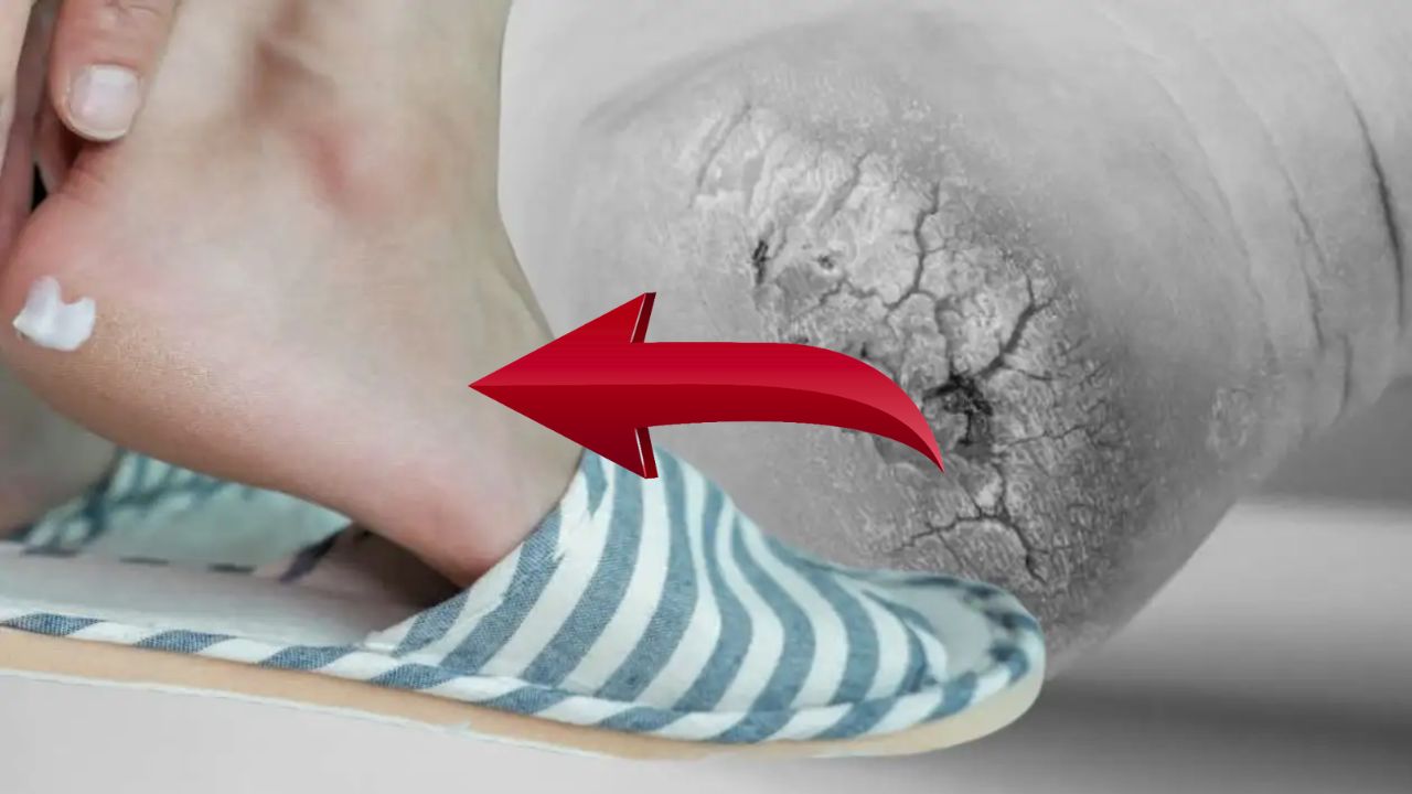 Skin Care not expensive creams but this home remedy will keep your feet soft even in winter