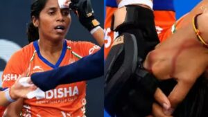Ishika Chaudhary suffers forehead injury at Hockey World Cup 2026.