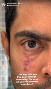 What Abhishek Banerjee is trying to convey by his recent post