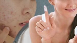 Beauty Tips follow these tips to avoid acne while wearing makeup during Puja