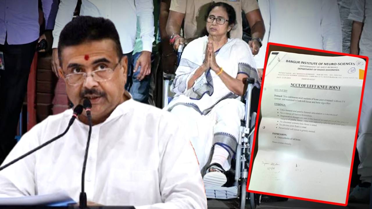 Suvendu Adhikari claims Mamata Banerjee leg was not broken during 2021 elections